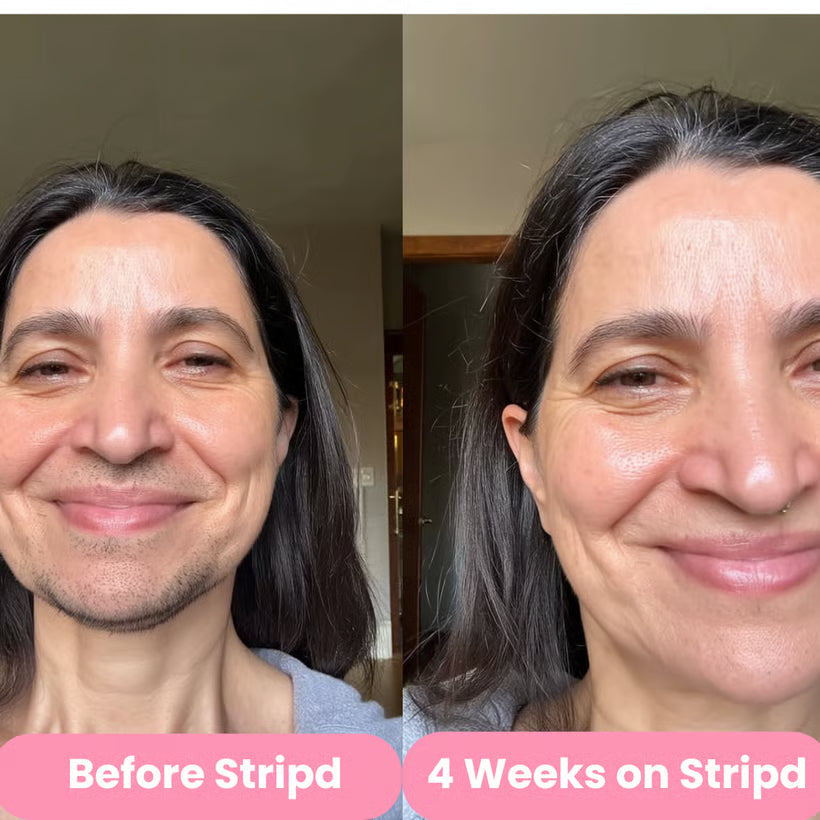 Stripd - Root Eraser Serum