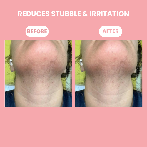 Stripd - Root Eraser Serum