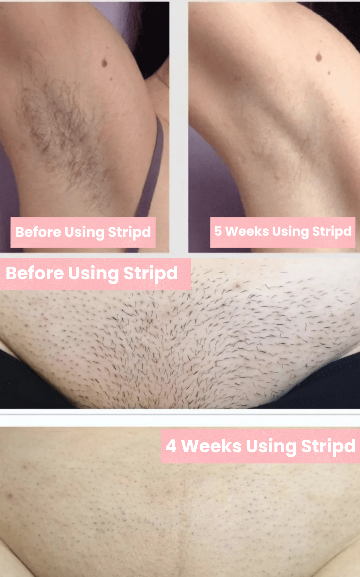 Stripd - Root Eraser Serum