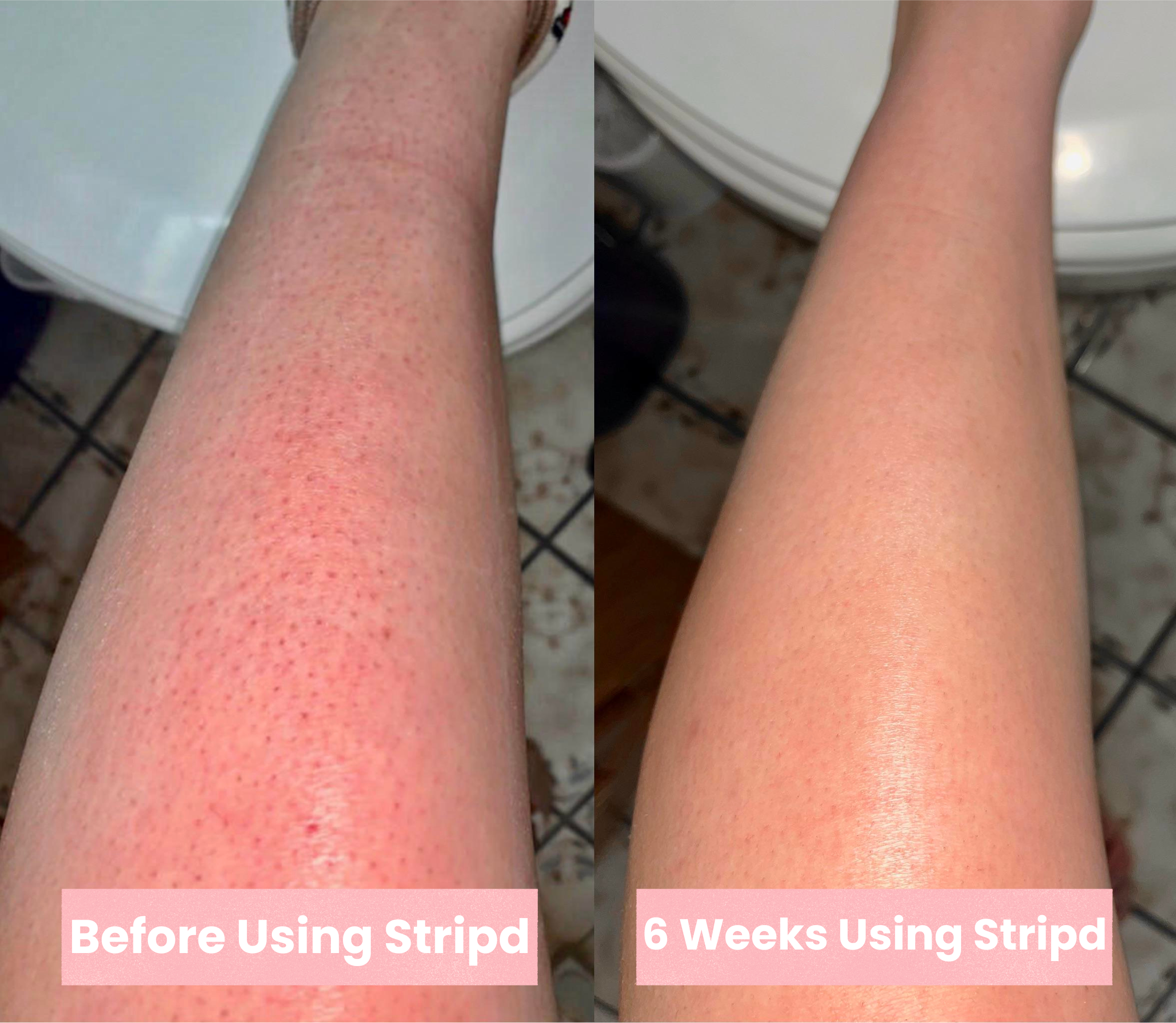 Stripd - Root Eraser Serum