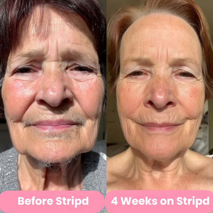 Stripd - Root Eraser Serum